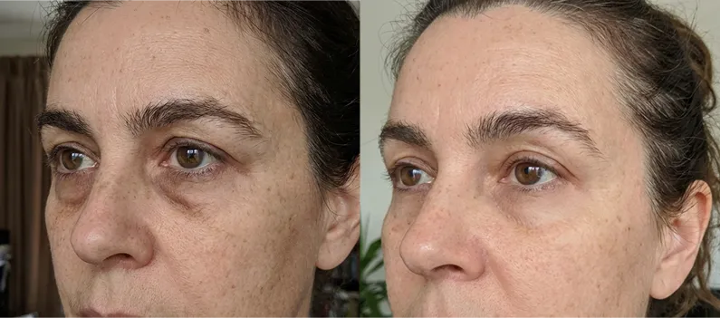 Dr. Melasmin money-back guarantee